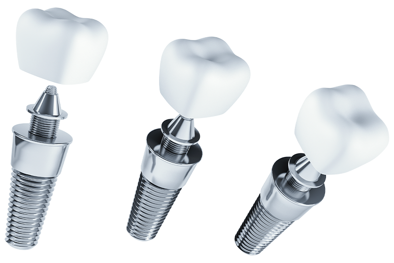 implants